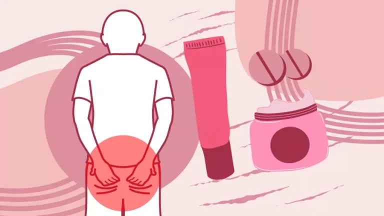 Why Does My Butthole Itch? Causes & Relief 2026