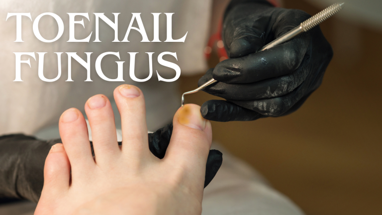 Why Are My Toenails Yellow? Signs You Should Know 2026 Why Are My Toenails Yellow? Signs You Should Know 2026