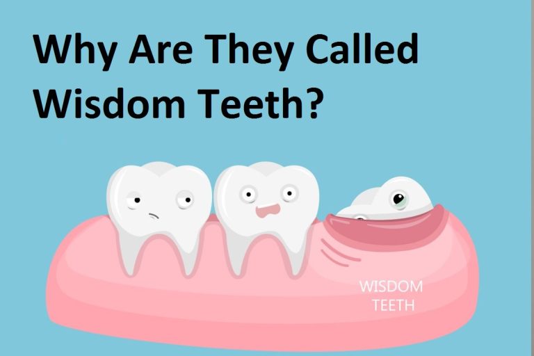 Why Are They Called Wisdom Teeth? Surprising Facts 2026