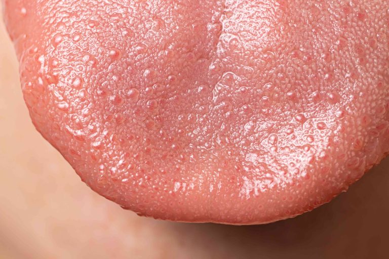 Why Does the Tip of My Tongue Hurt? What It Means 2026