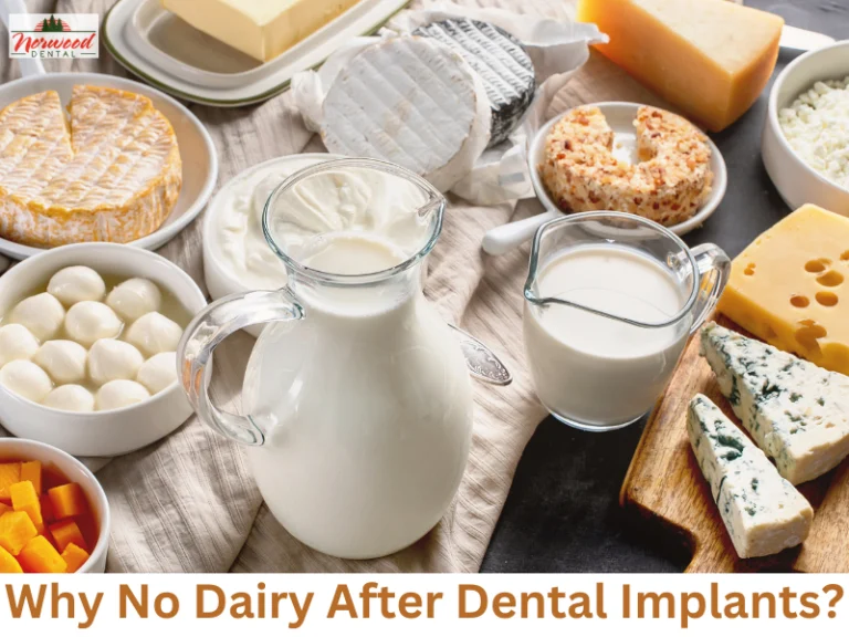 Why No Dairy After Dental Implant? Food Restrictions 2026