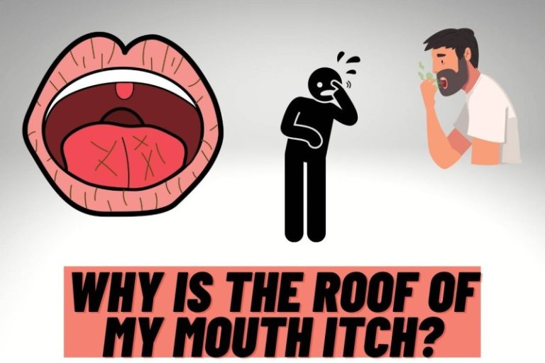 Why Does the Roof of My Mouth Itch? Allergy Signs 2026