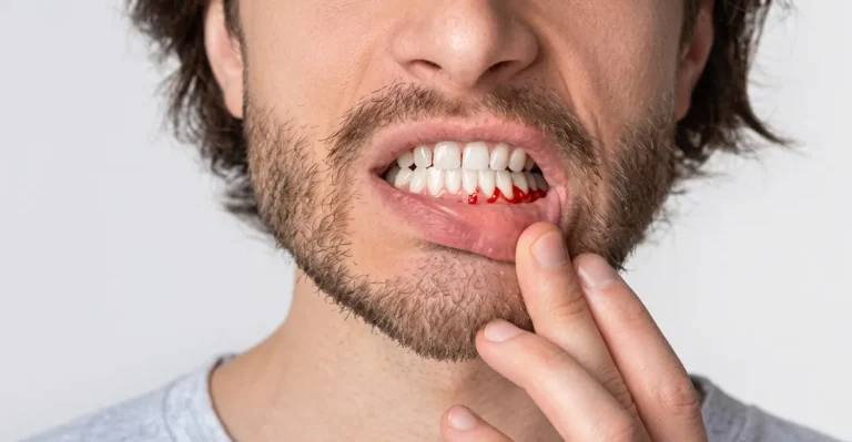 Why Do My Gums Suddenly Hurt? Causes and Relief Tips 2026