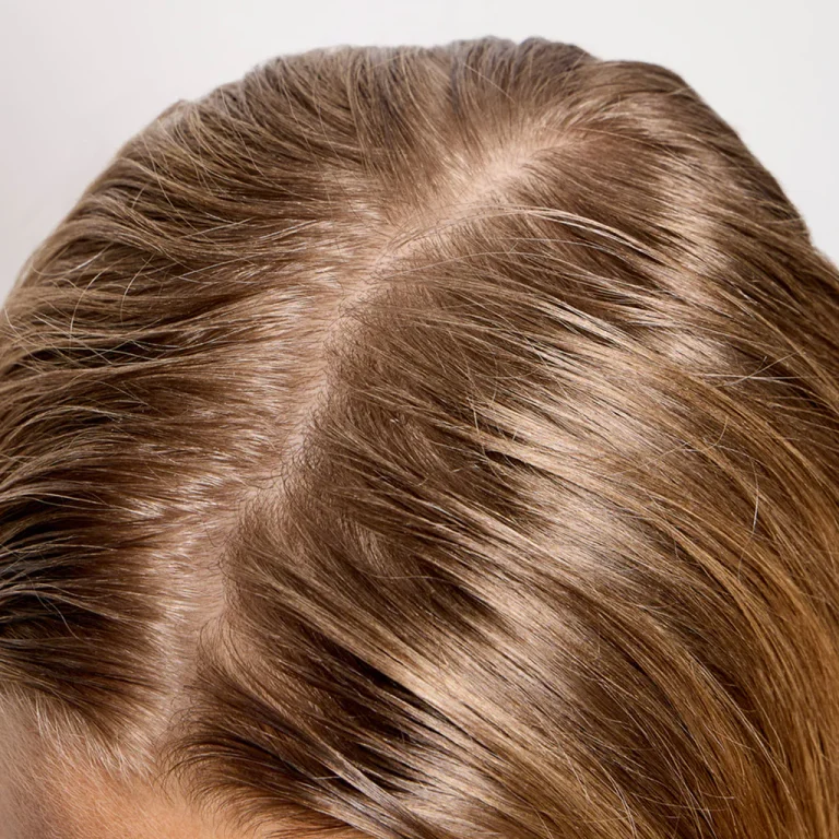 Why Does My Hair Get Greasy After One Day? Hair Tips 2026 Why Does My Hair Get Greasy After One Day? Hair Tips 2026