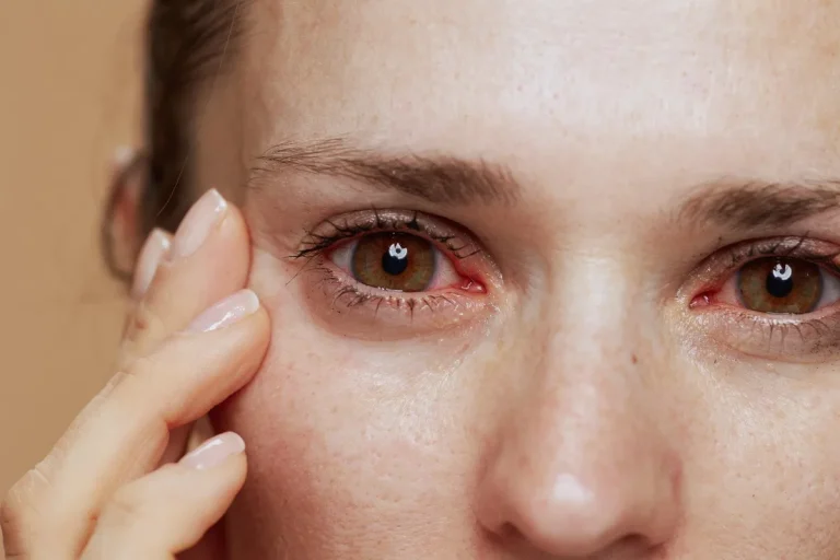 Why Does My Eyeball Hurt? Signs You Shouldn't Ignore 2026