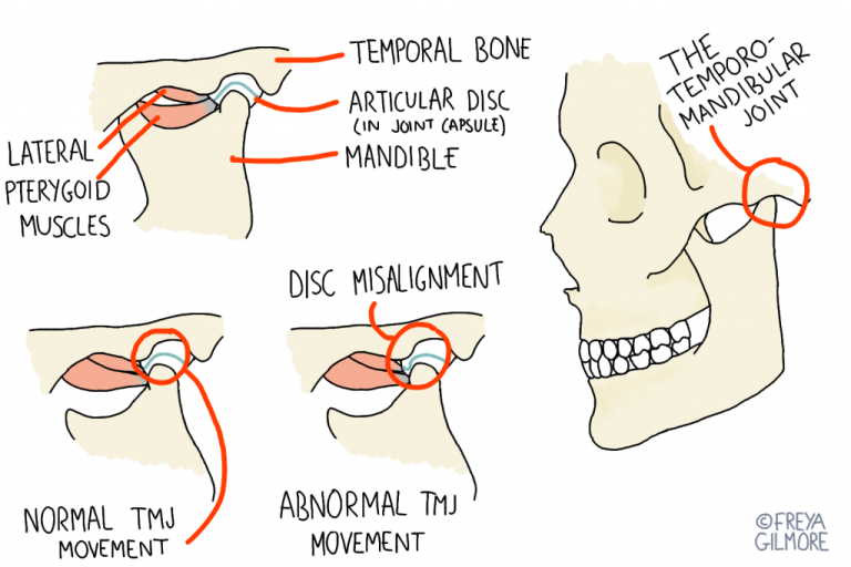 Why Does My Jaw Keep Locking? Expert Answers 2026