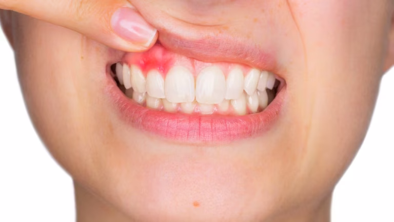 Why Does My Gum Hurt? Causes and Treatments 2026
