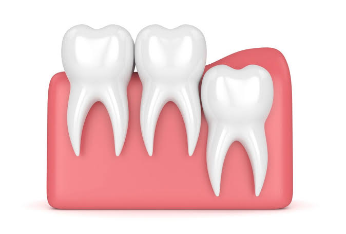 Why Is It Called Wisdom Teeth? The Real Origin Explained 2026