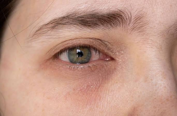 Why Do My Eyelids Itch? Common Causes Explained 2026