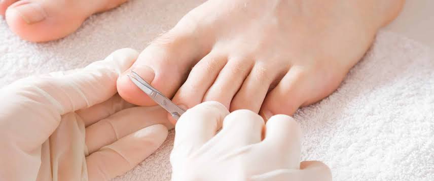 Why Do My Toenails Smell When I Cut Them? Real Causes & Fixes 2026