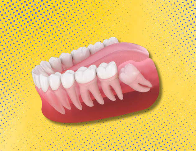 Why Is It Called Wisdom Teeth? The Real Origin Explained 2026