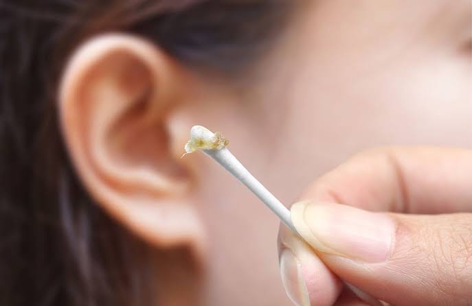 Why Is My Earwax Wet? Causes, Normal Types, and Warning Signs 2026