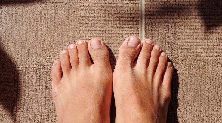 Why Do Toenails Turn Yellow? Causes Explained 2026