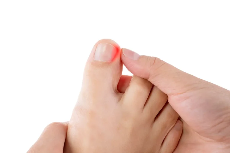 Why Do My Toenails Smell? Treatment Tips 2026