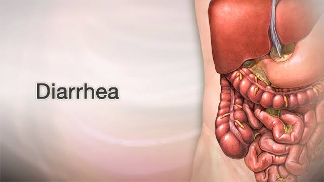 Why Do I Have Diarrhea All the Time? Causes Explained 2026
