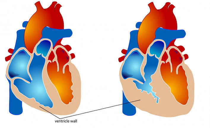 Why Is the Left Ventricle Thicker Than the Right? Key Facts 2026