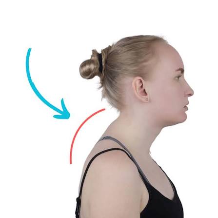 Why Do I Have a Hump on the Back of My Neck? Causes & Fixes 2026