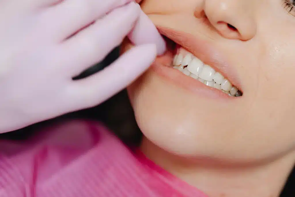 Why Are My Gums Purple? Causes & What It Means 2026